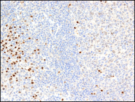 PIM2 antibody (mAb) tested by Immunohistochemistry PIM2 detected by immunohistochemistry in paraffin-embedded human tonsil cells.