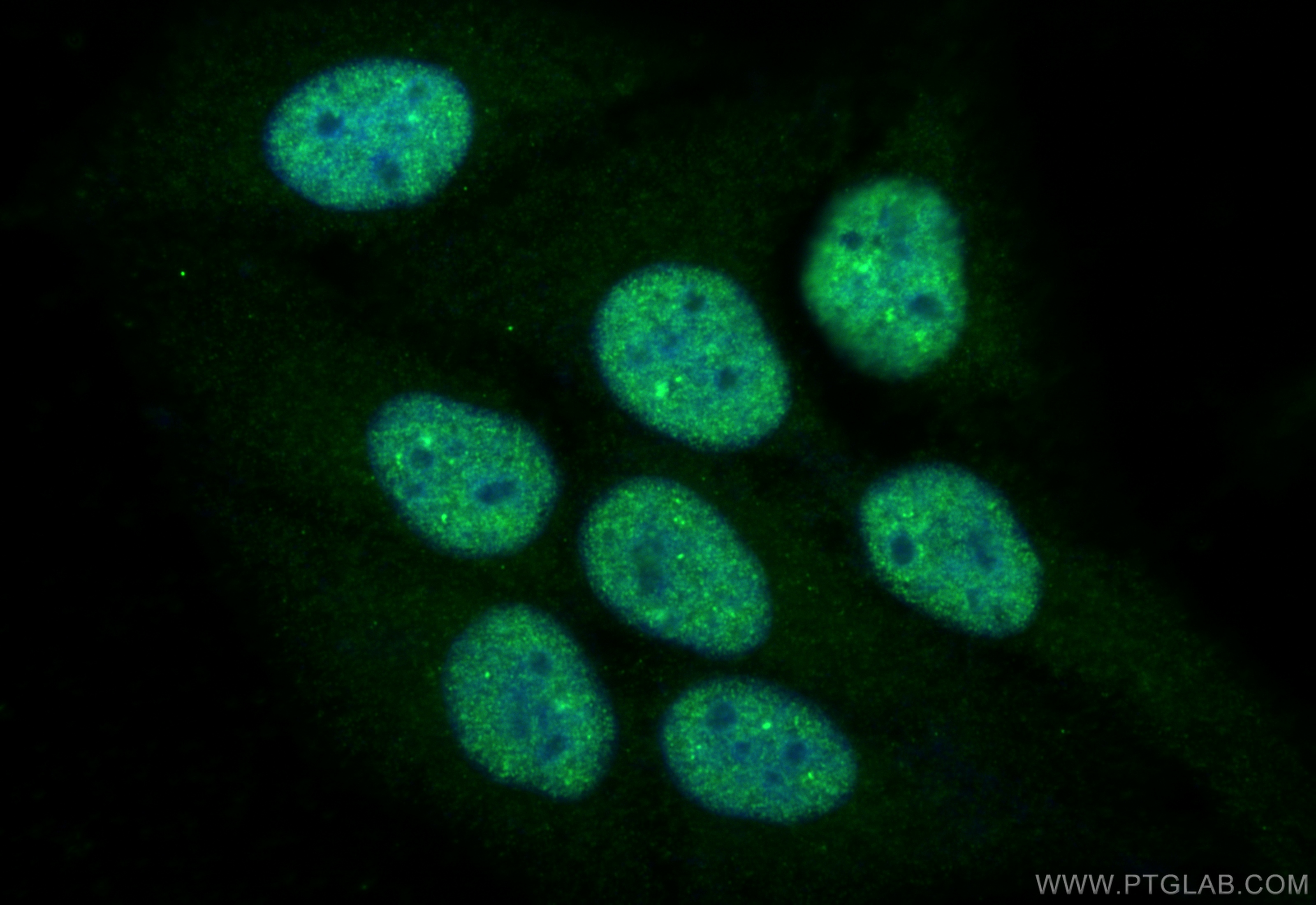 Immunofluorescence (IF) / fluorescent staining of HepG2 cells using PIN4 Polyclonal antibody (15789-1-AP)