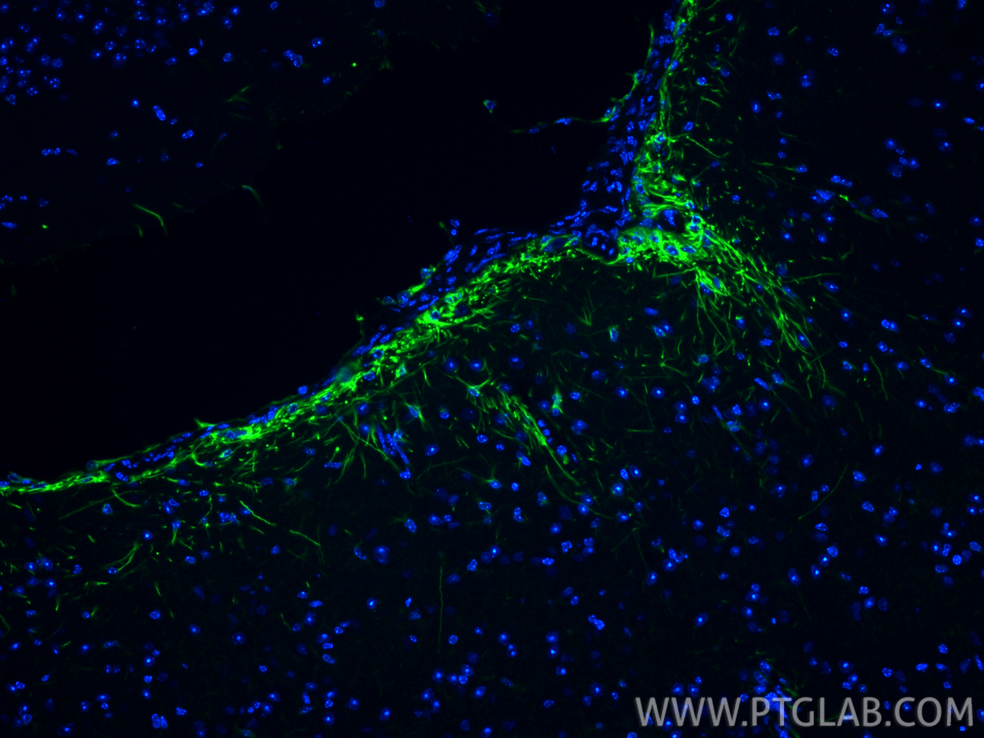 Immunofluorescence (IF) / fluorescent staining of mouse brain tissue using CoraLite® Plus 488-conjugated PINK1 Recombinant an (CL488-81991-4)