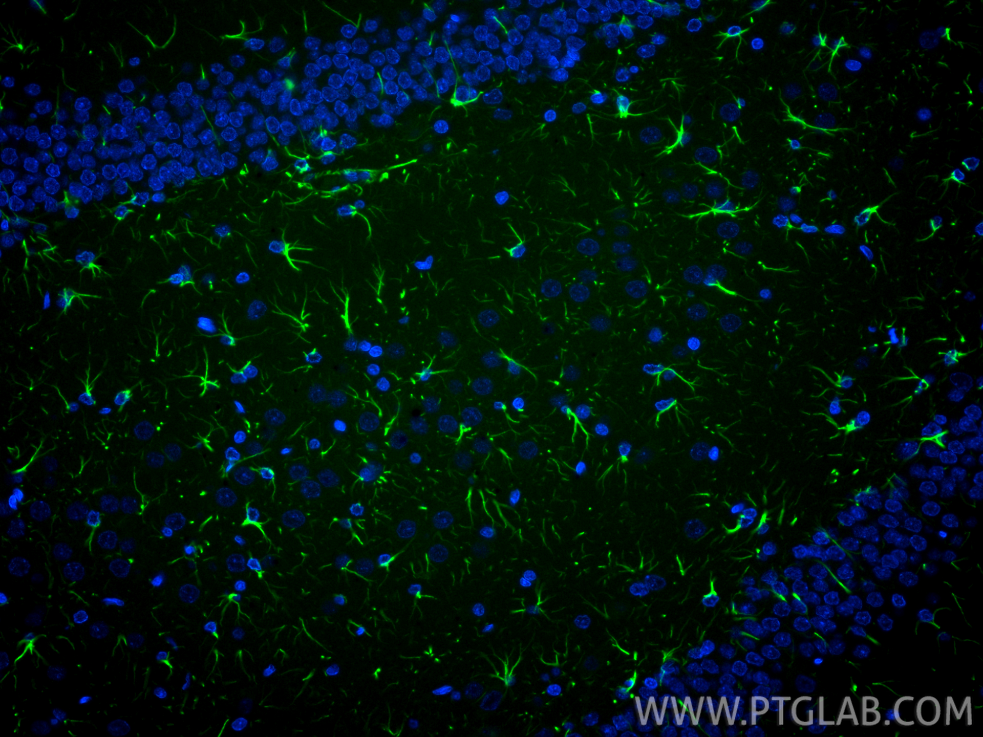Immunofluorescence (IF) / fluorescent staining of rat brain tissue using CoraLite® Plus 488-conjugated PINK1 Recombinant an (CL488-81991-4)