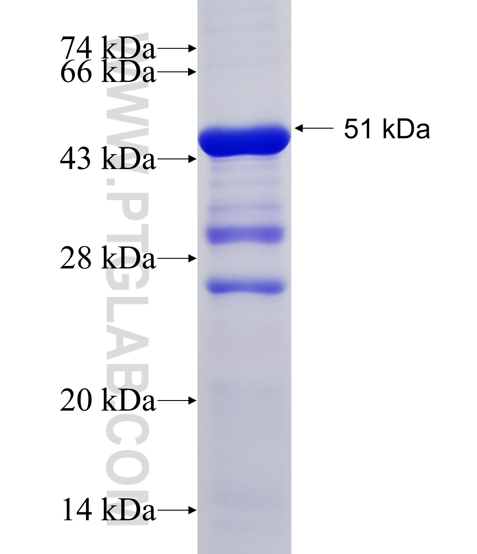 PIP4K2A fusion protein Ag34702 SDS-PAGE