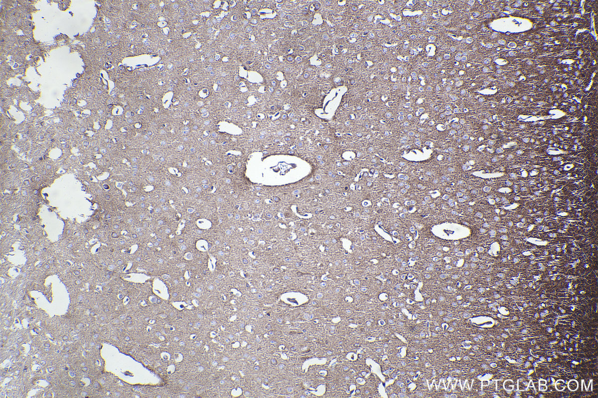 Immunohistochemistry (IHC) staining of mouse brain tissue using PIP4K2B Recombinant antibody (83647-3-RR)