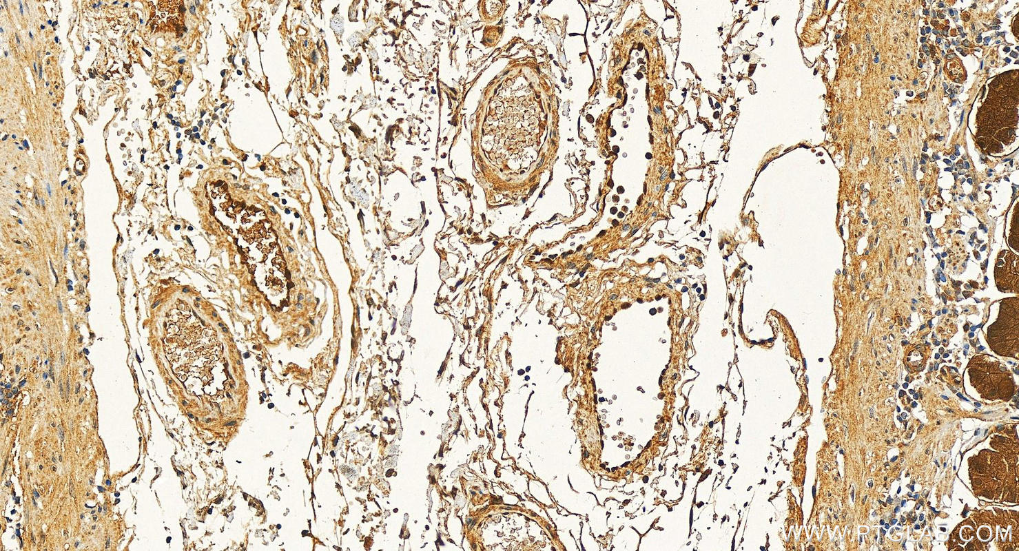 Immunohistochemistry (IHC) staining of human stomach tissue using PIR Polyclonal antibody (10263-1-AP)