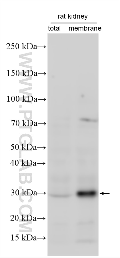 Western Blot (WB) analysis of various lysates using PIRT Polyclonal antibody (20990-1-AP)