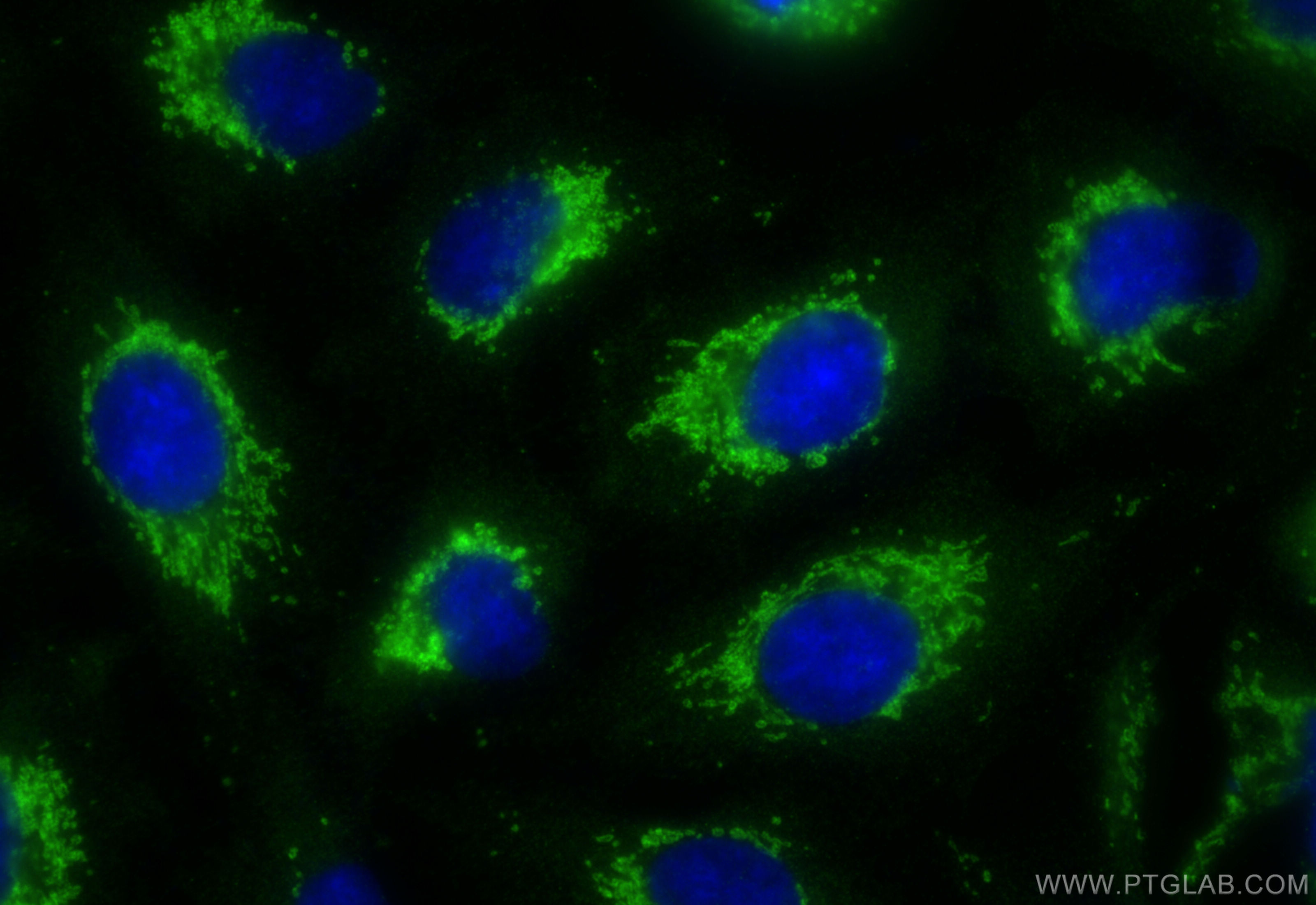 Immunofluorescence (IF) / fluorescent staining of A549 cells using PITRM1 Polyclonal antibody (10101-2-AP)