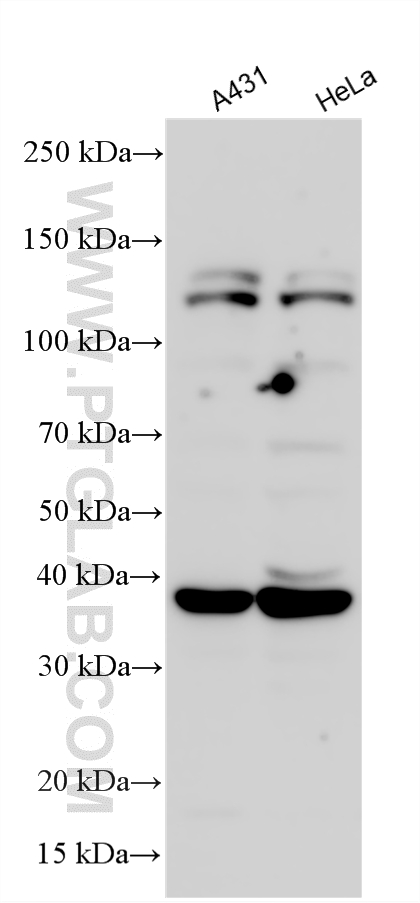 Western Blot (WB) analysis of various lysates using PITX1 Polyclonal antibody (10873-1-AP)