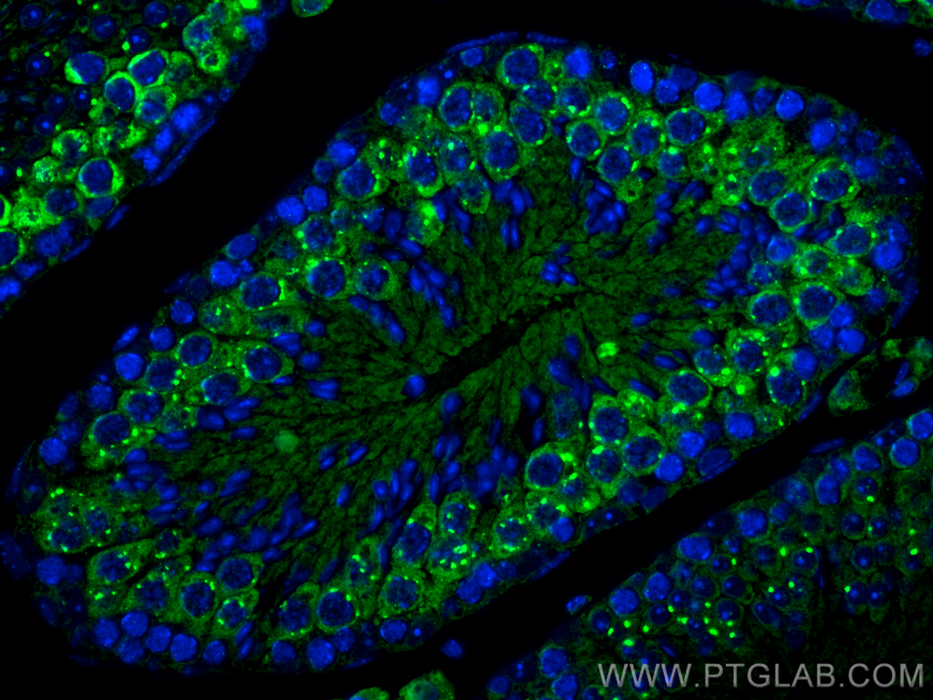 Immunofluorescence (IF) / fluorescent staining of mouse testis tissue using PIWIL1 Polyclonal antibody (15659-1-AP)