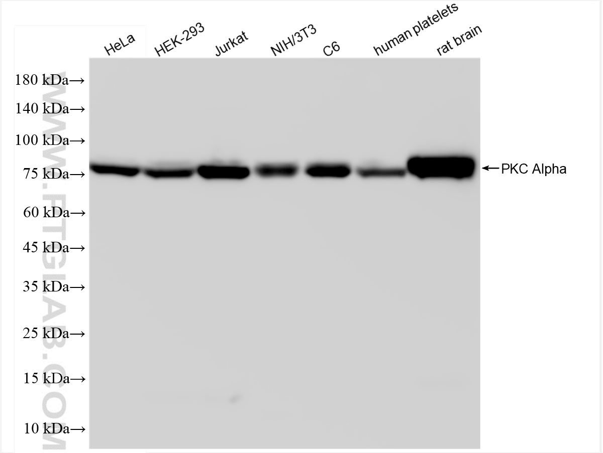 Western Blot (WB) analysis of various lysates using PKC Alpha Recombinant antibody (83840-5-RR)