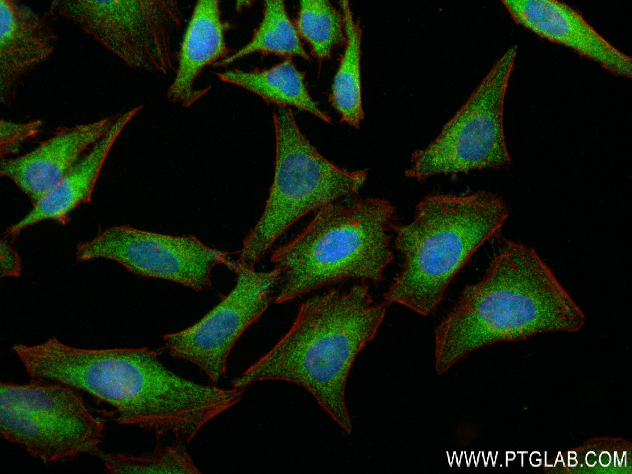 Immunofluorescence (IF) / fluorescent staining of HeLa cells using PKC Delta Recombinant antibody (84261-5-RR)