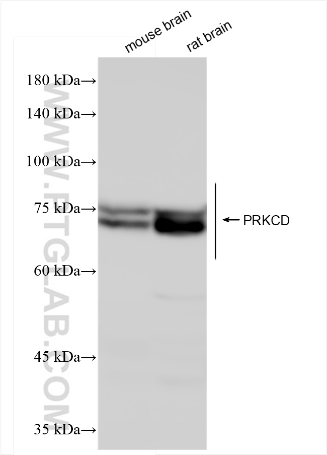 Western Blot (WB) analysis of various lysates using PKC Delta Recombinant antibody (84261-5-RR)