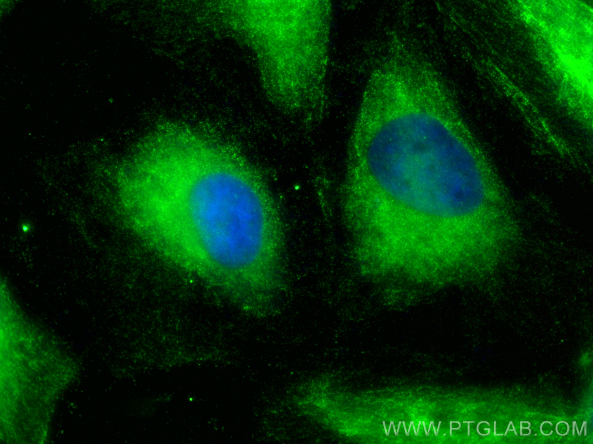 Immunofluorescence (IF) / fluorescent staining of HeLa cells using PKC Zeta Polyclonal antibody (26899-1-AP)