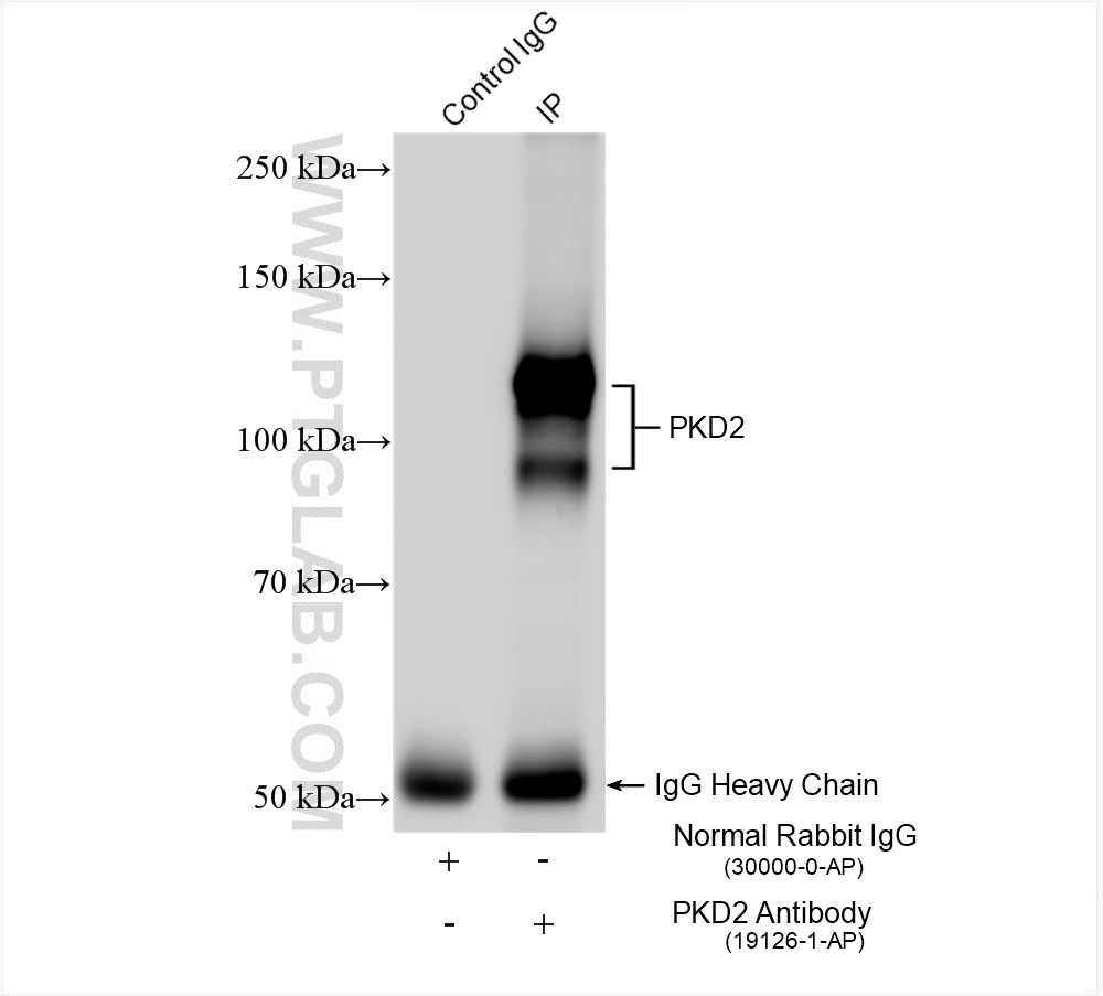 Immunoprecipitation (IP) experiment of mouse testis tissue using Polycystin 2 Polyclonal antibody (19126-1-AP)