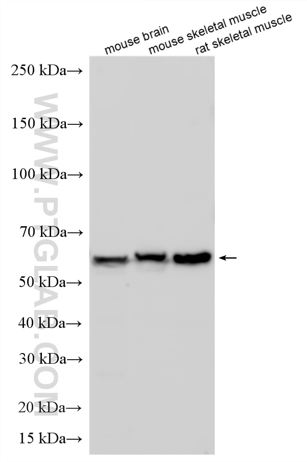 Western Blot (WB) analysis of various lysates using PKM Polyclonal antibody (10078-2-AP)