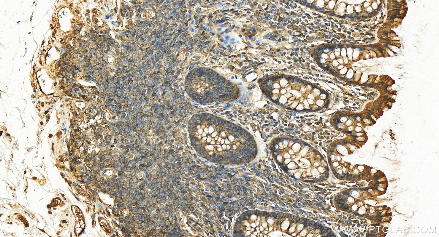 Immunohistochemistry (IHC) staining of human colon tissue using PKM2-specific Polyclonal antibody (15822-1-AP)