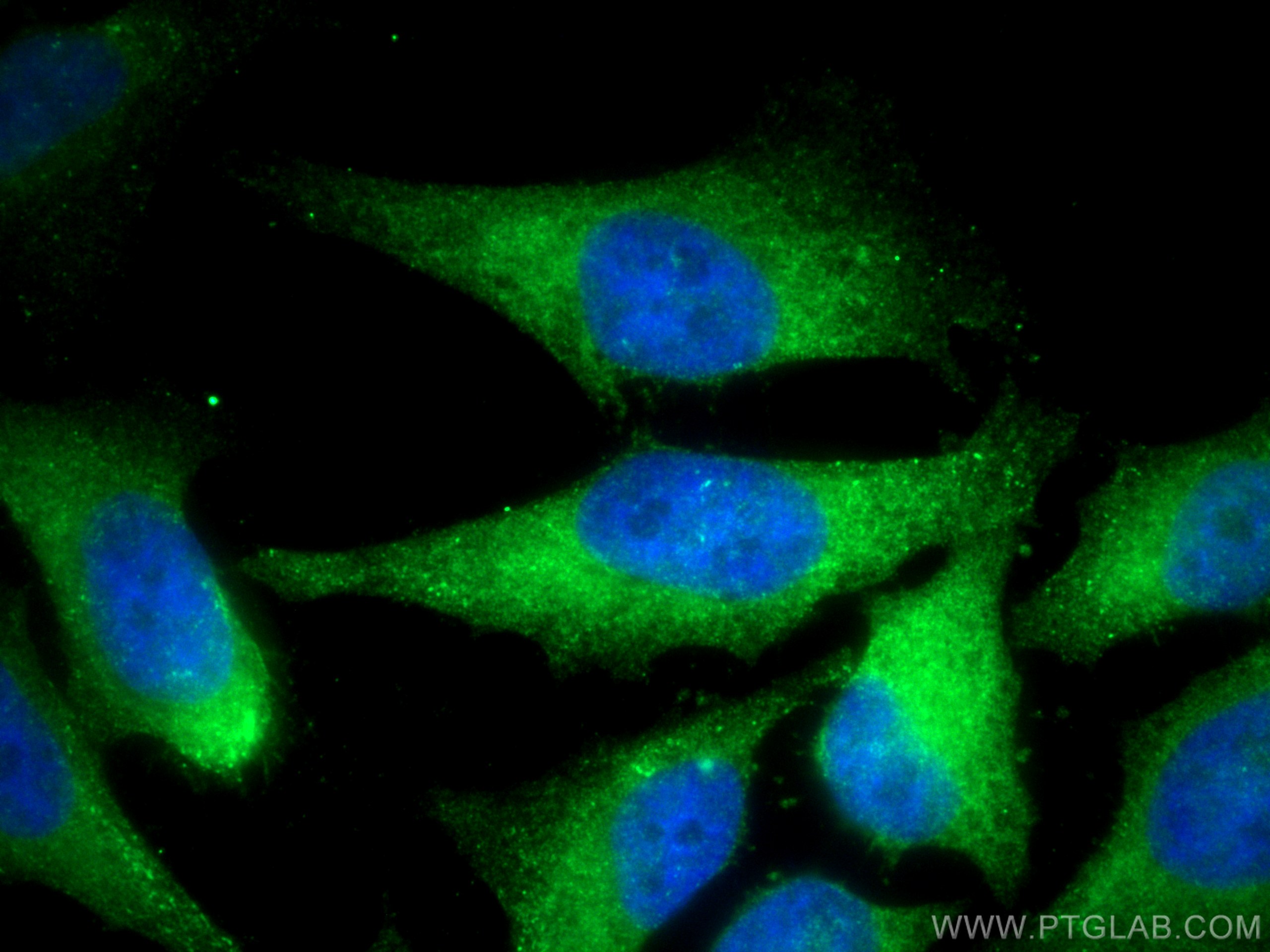 Immunofluorescence (IF) / fluorescent staining of HeLa cells using PKM2-specific Polyclonal antibody (15822-1-AP)