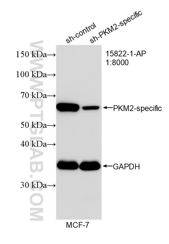 Western Blot (WB) analysis of MCF-7 cells using PKM2-specific Polyclonal antibody (15822-1-AP)