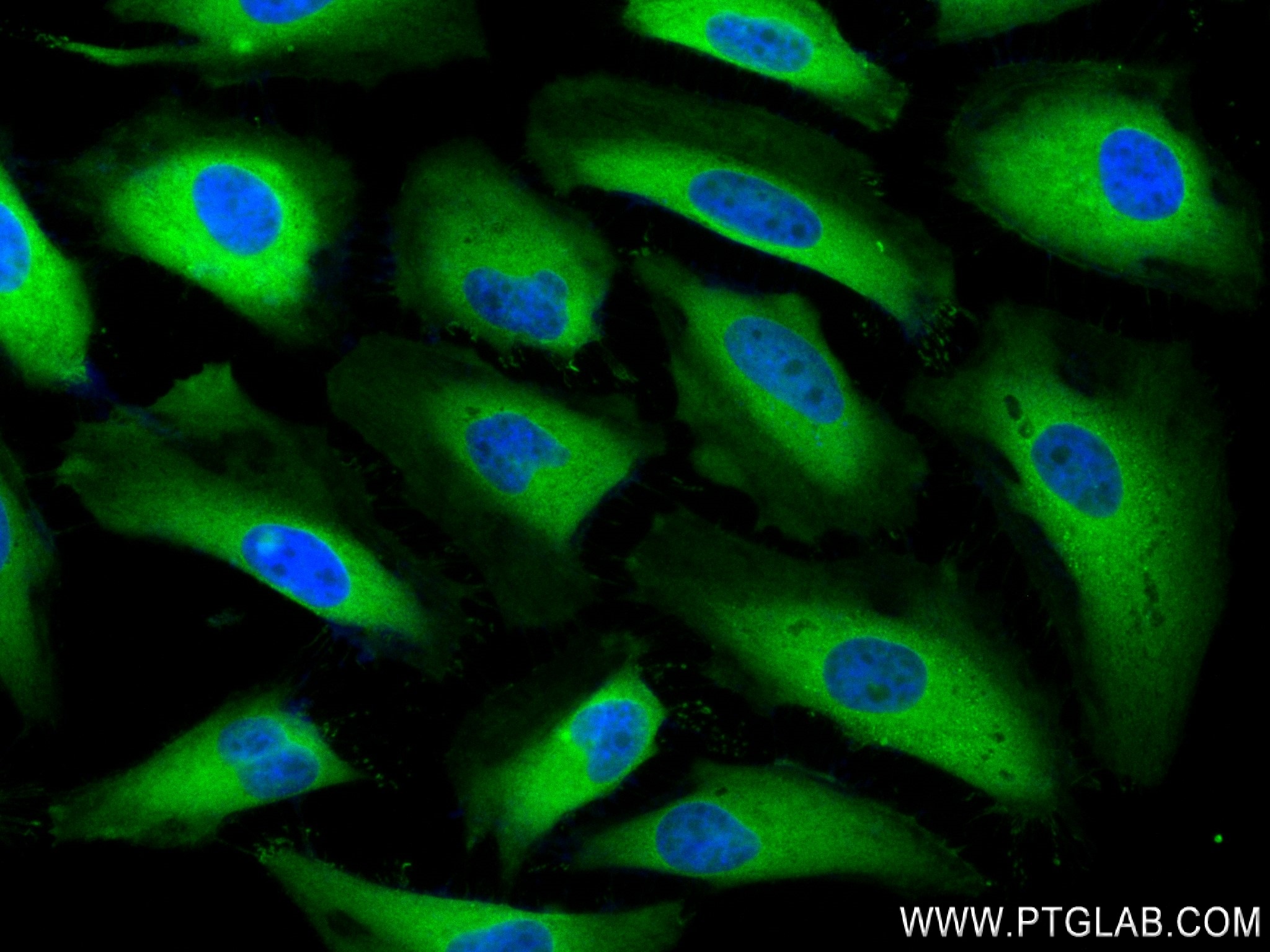 Immunofluorescence (IF) / fluorescent staining of HeLa cells using PKM2-specific Recombinant antibody (84451-1-RR)