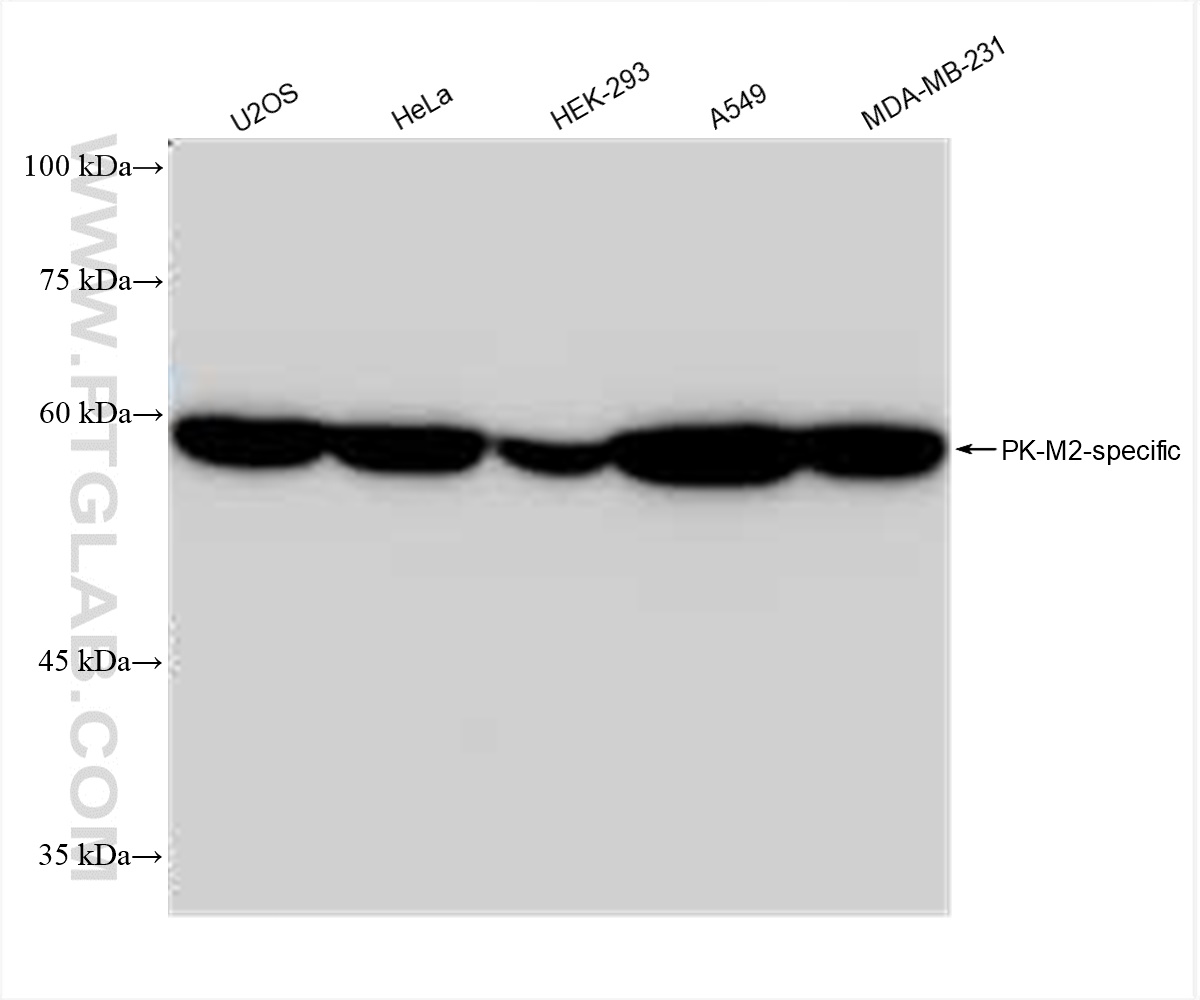 Western Blot (WB) analysis of various lysates using PKM2-specific Recombinant antibody (84451-1-RR)