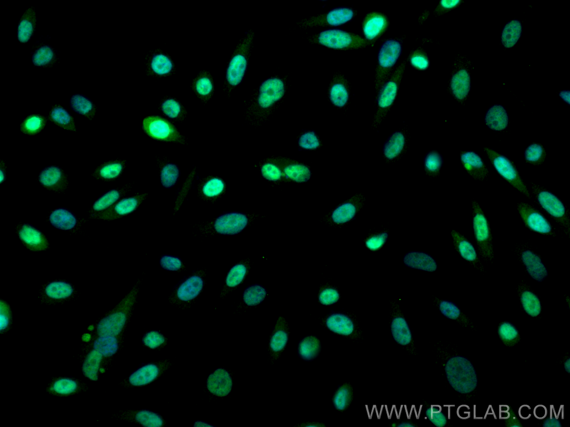 Immunofluorescence (IF) / fluorescent staining of PC-3 cells using PKP1 Polyclonal antibody (22632-1-AP)