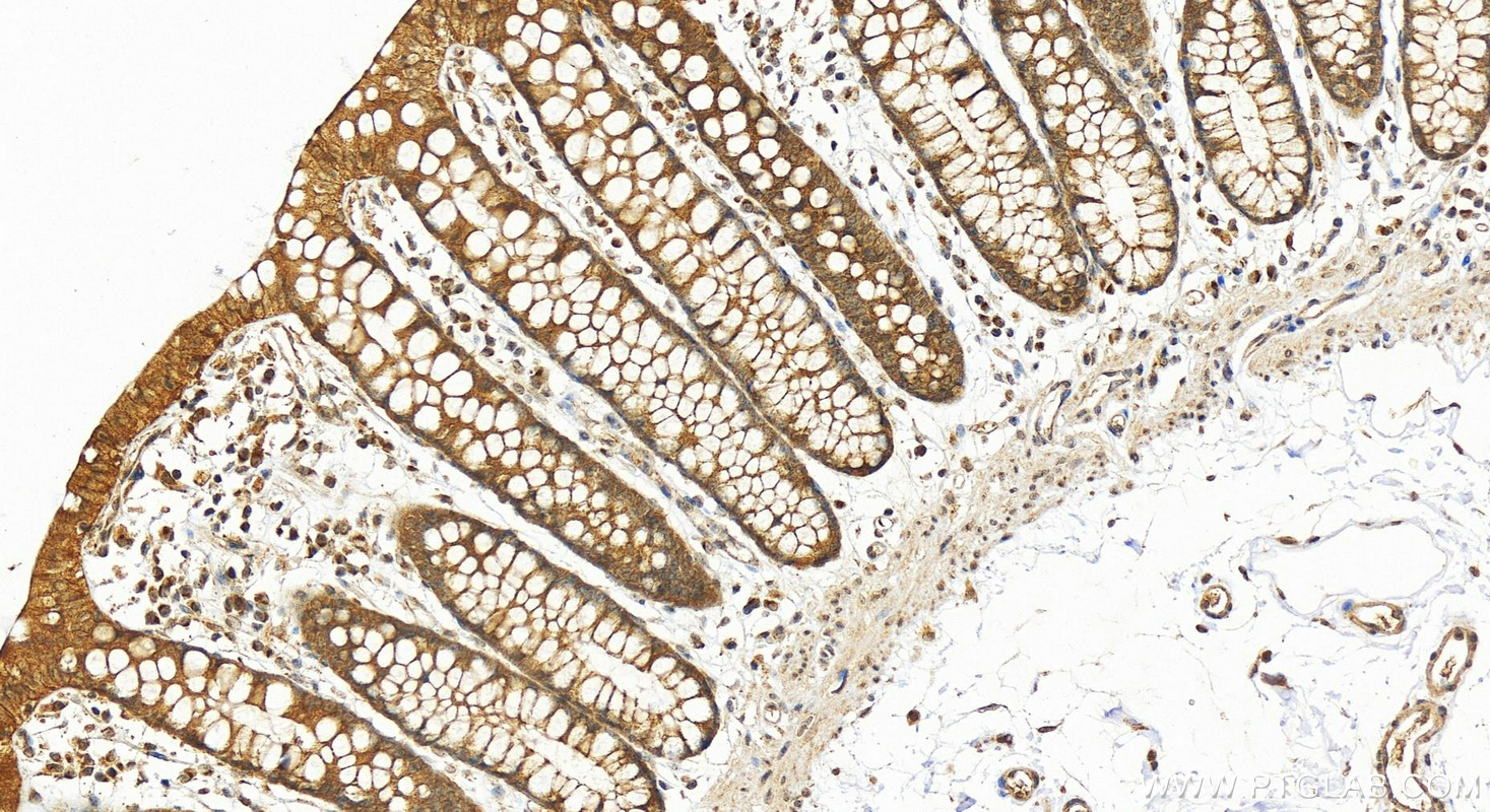 Immunohistochemistry (IHC) staining of human colon tissue using Plakophilin 3 Polyclonal antibody (18338-1-AP)