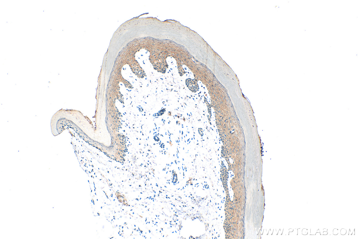 Immunohistochemistry (IHC) staining of mouse skin tissue using Plakophilin 3 Polyclonal antibody (18338-1-AP)