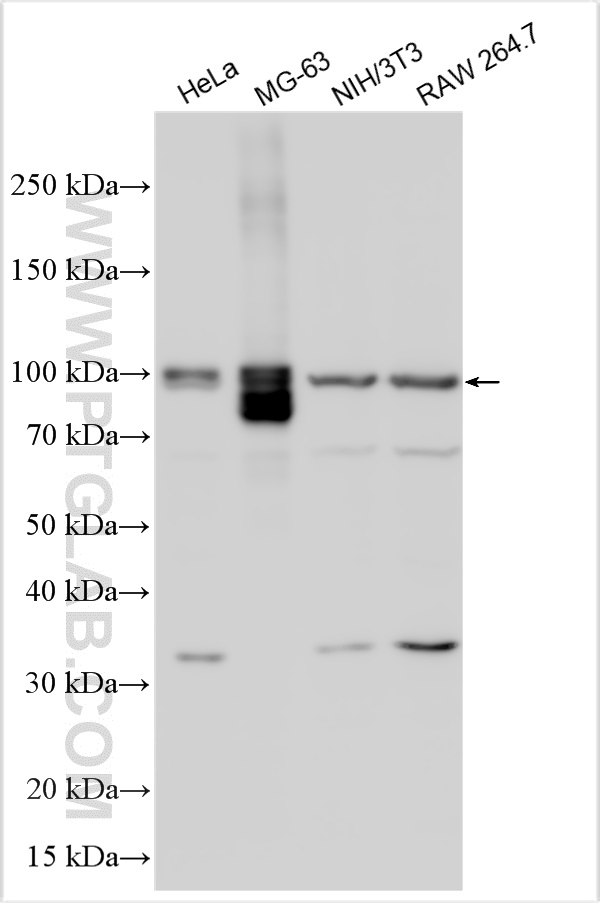 Western Blot (WB) analysis of various lysates using PLA2G4A Polyclonal antibody (21004-1-AP)