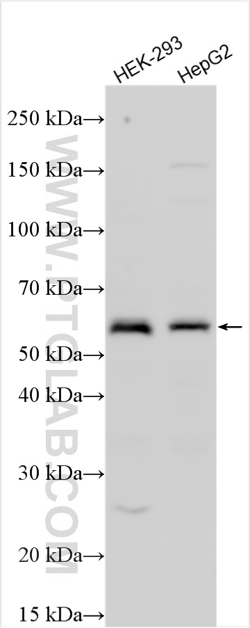 Western Blot (WB) analysis of various lysates using PLAG1 Polyclonal antibody (28651-1-AP)