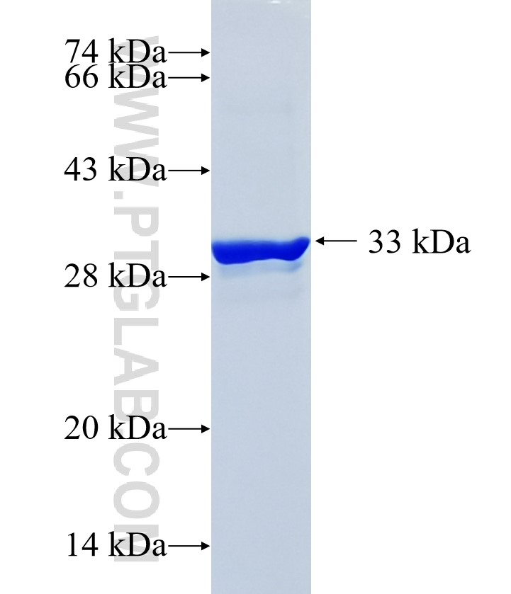 PLAG1 fusion protein Ag29010 SDS-PAGE