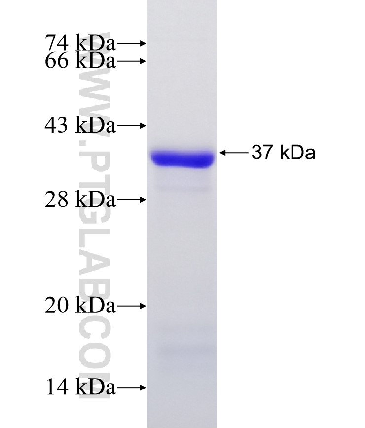 PLAGL2 fusion protein Ag30227 SDS-PAGE