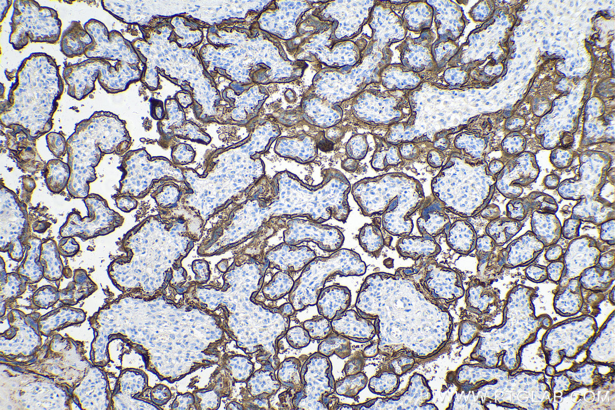 Immunohistochemistry (IHC) staining of human placenta tissue using PLAP Monoclonal antibody (60294-1-Ig)