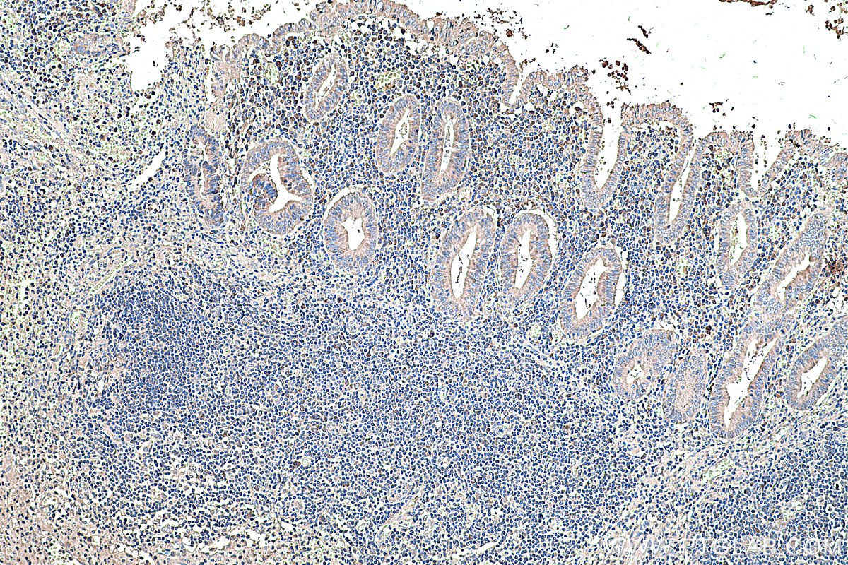 Immunohistochemistry (IHC) staining of human appendicitis tissue using PLAP Monoclonal antibody (60294-1-Ig)