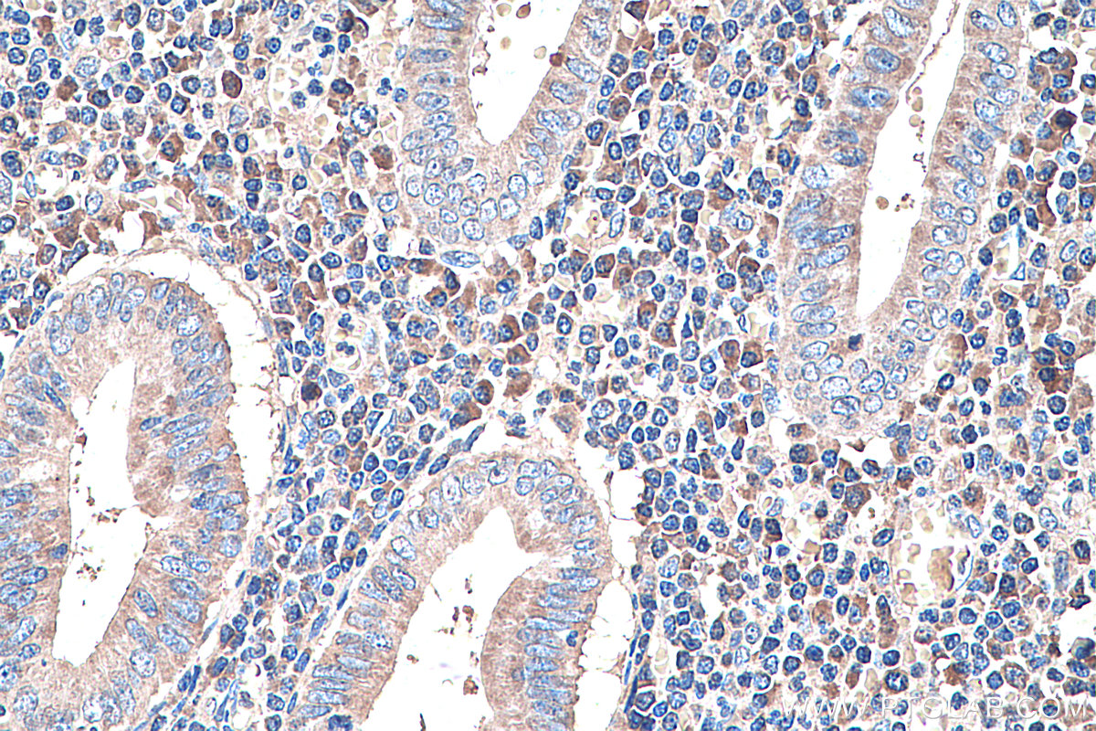 Immunohistochemistry (IHC) staining of human appendicitis tissue using PLAP Monoclonal antibody (60294-1-Ig)