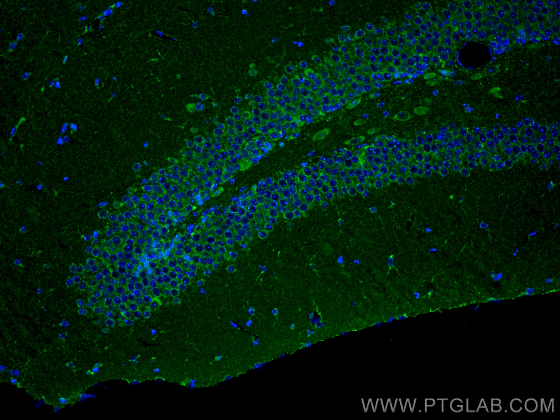 Immunofluorescence (IF) / fluorescent staining of mouse brain tissue using t-Plasminogen activator/tPA Polyclonal antibody (10147-1-AP)