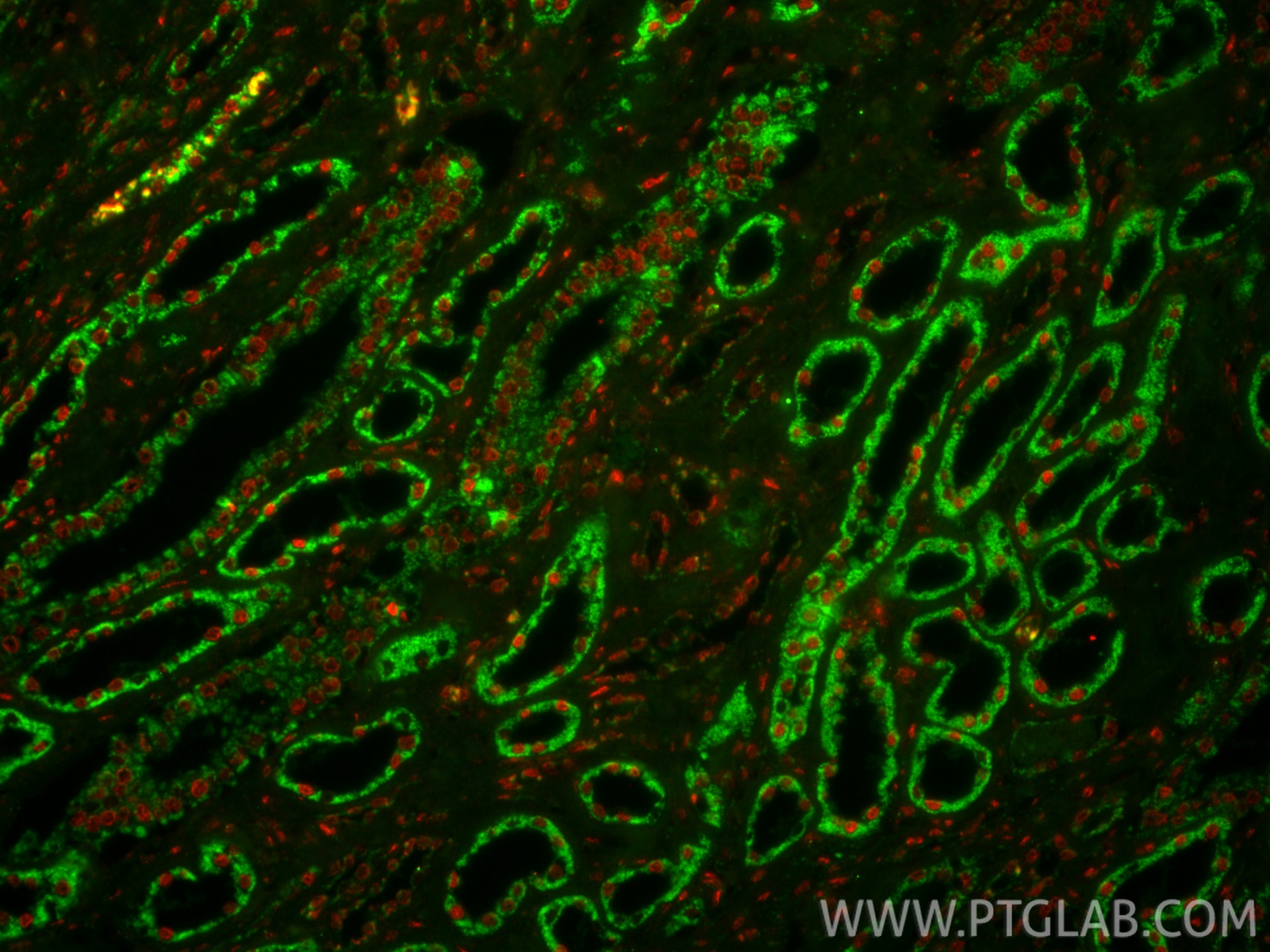 Immunofluorescence (IF) / fluorescent staining of human kidney tissue using uPA/Urokinase Polyclonal antibody (17968-1-AP)