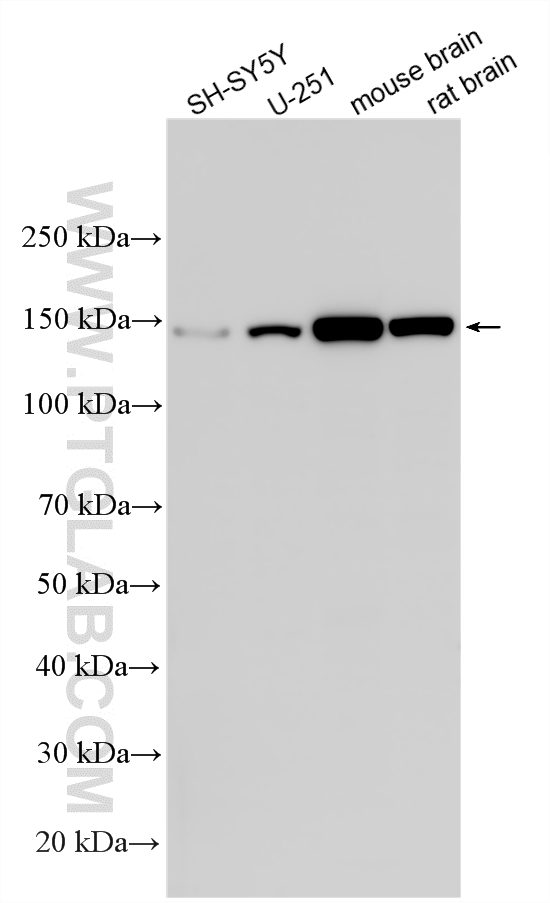Western Blot (WB) analysis of various lysates using Phospholipase C Beta 1 Polyclonal antibody (26551-1-AP)