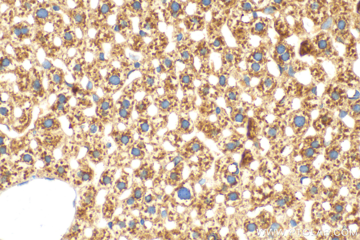 Immunohistochemistry (IHC) staining of mouse liver tissue using PLCB2 Polyclonal antibody (27456-1-AP)