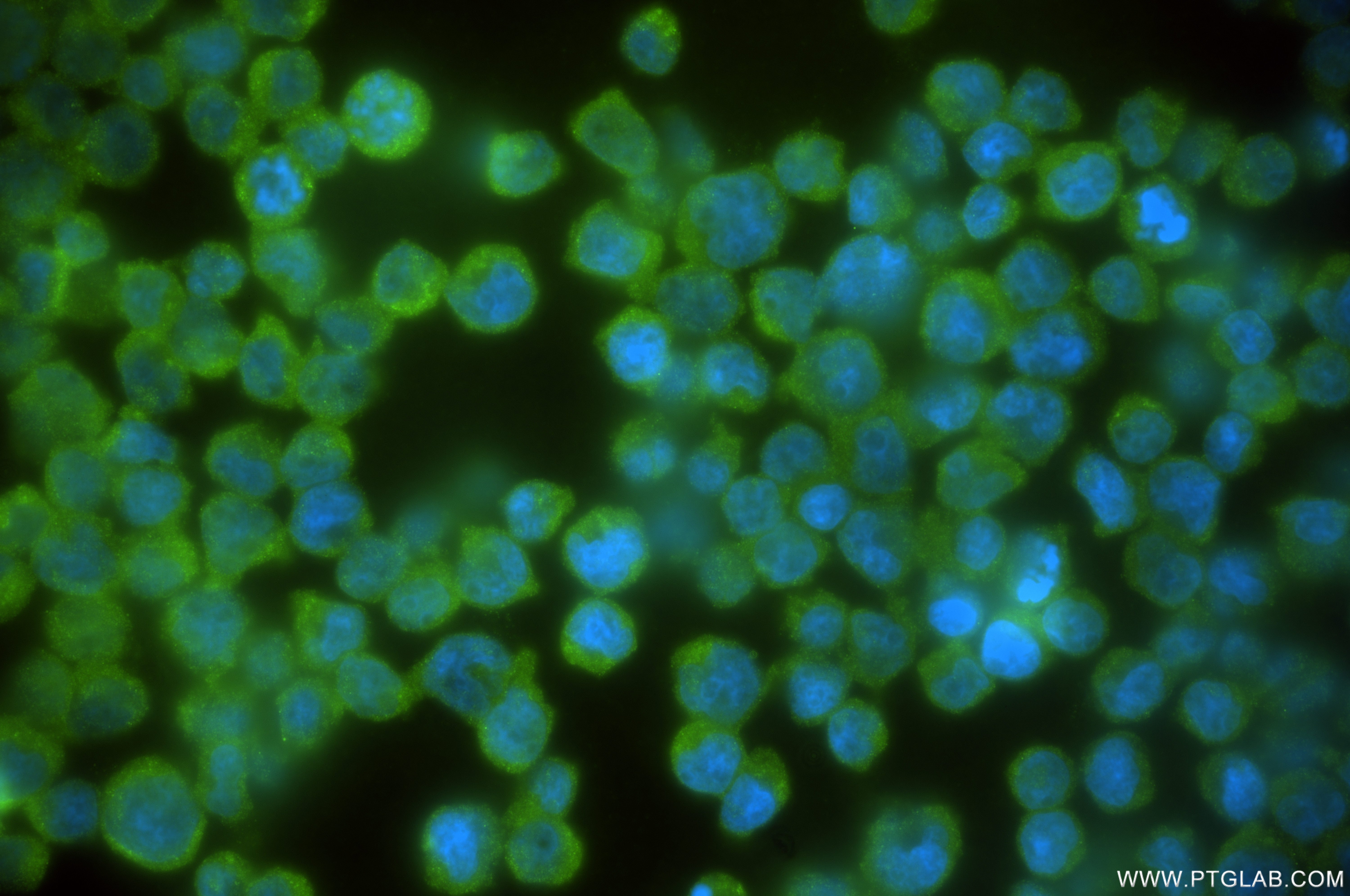 Immunofluorescence (IF) / fluorescent staining of Jurkat cells using PLCG1 Recombinant antibody (84941-1-RR)