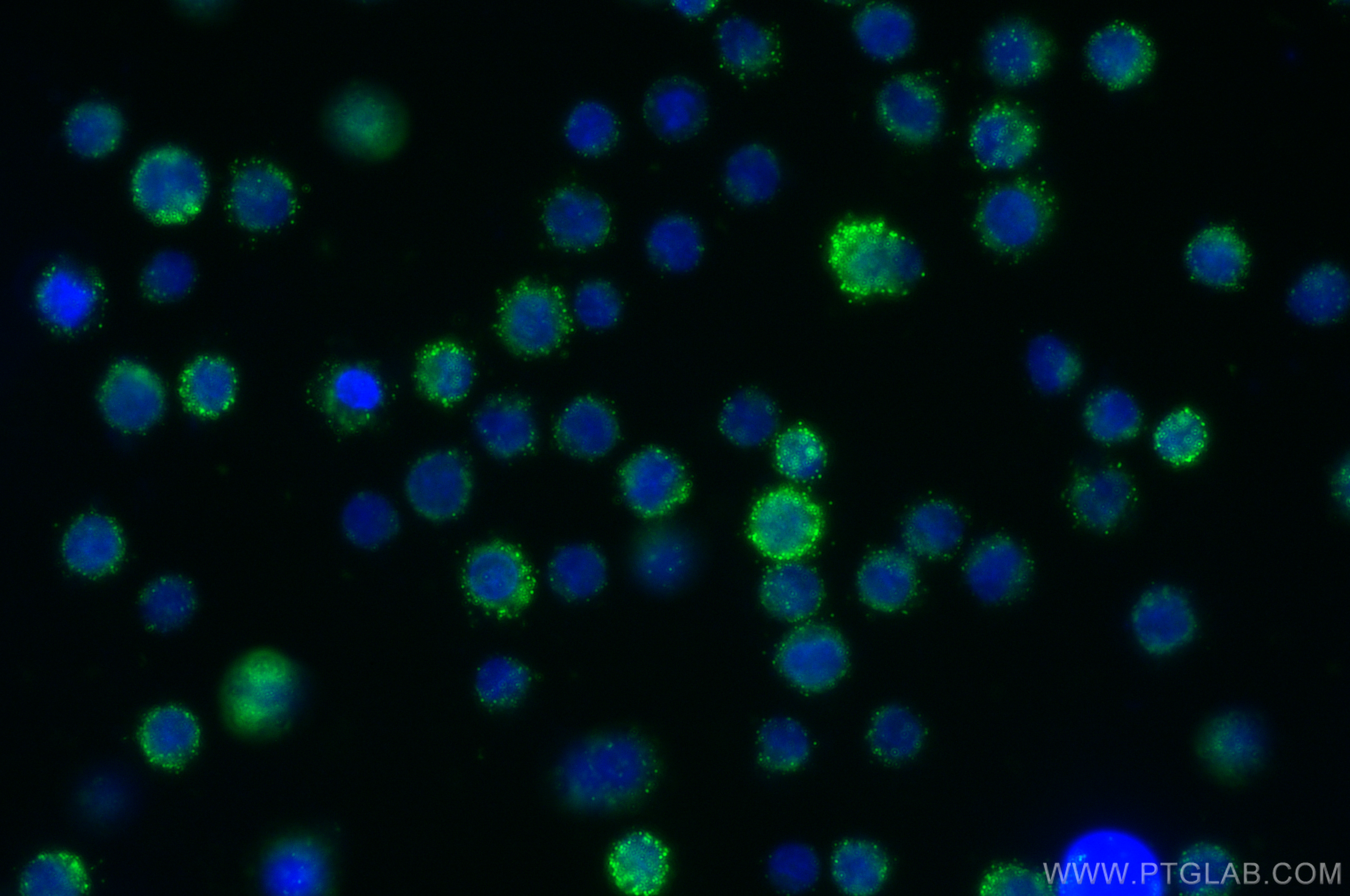 Immunofluorescence (IF) / fluorescent staining of U-937 cells using PLCG2 Polyclonal antibody (29567-1-AP)