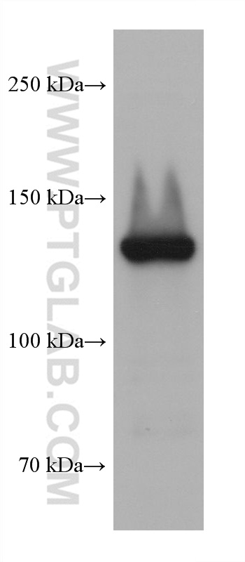 Western Blot (WB) analysis of Karpas-422 cells using PLCG2 Monoclonal antibody (67011-1-Ig)