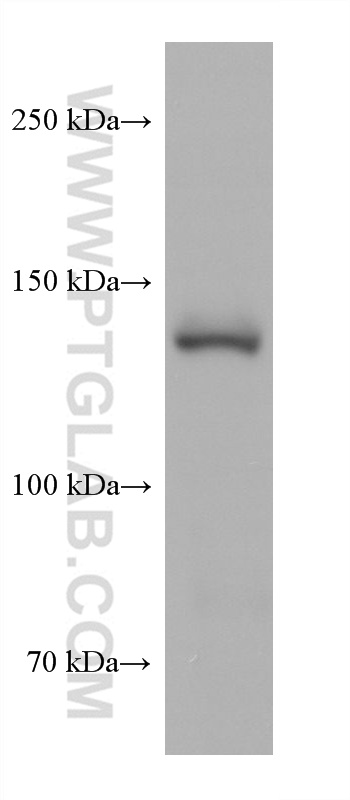 Western Blot (WB) analysis of rabbit spleen tissue using PLCG2 Monoclonal antibody (67011-1-Ig)