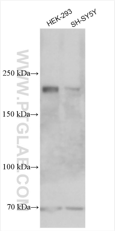 Western Blot (WB) analysis of various lysates using PLCH1 Polyclonal antibody (19143-1-AP)