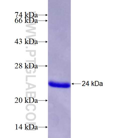 PLD2 fusion protein Ag28392 SDS-PAGE