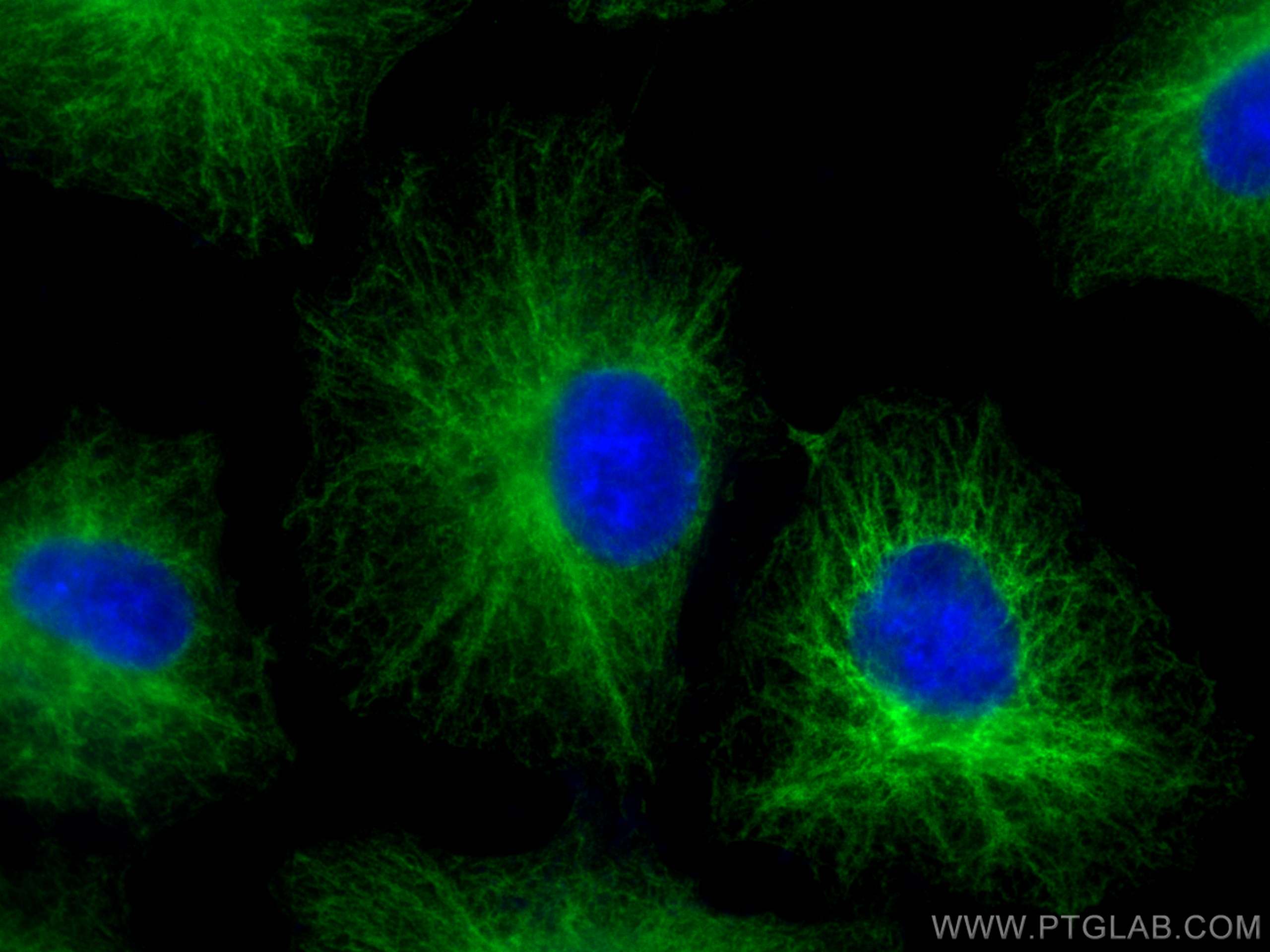 Immunofluorescence (IF) / fluorescent staining of A549 cells using PLEC Polyclonal antibody (29170-1-AP)