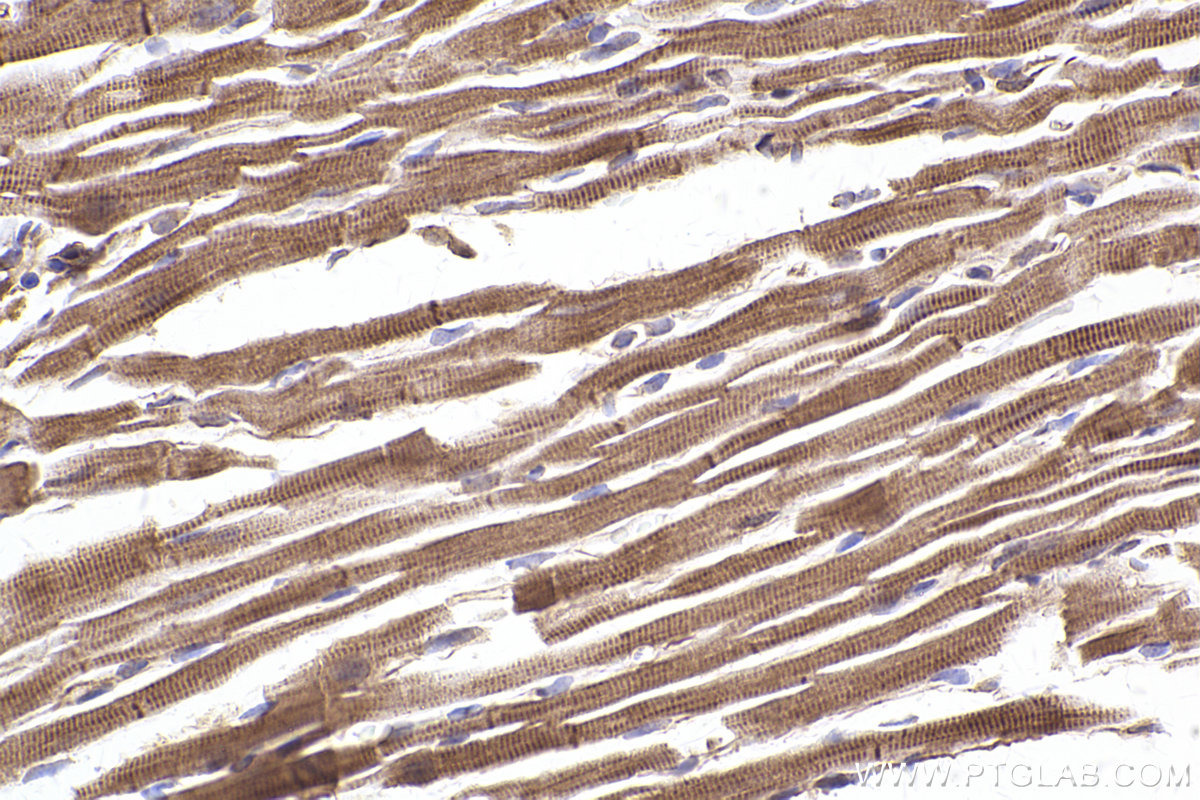 Immunohistochemistry (IHC) staining of mouse heart tissue using PLEC Polyclonal antibody (29170-1-AP)