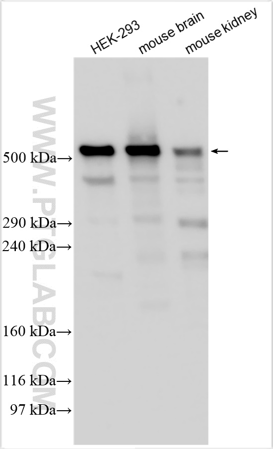 Western Blot (WB) analysis of various lysates using PLEC Polyclonal antibody (29170-1-AP)