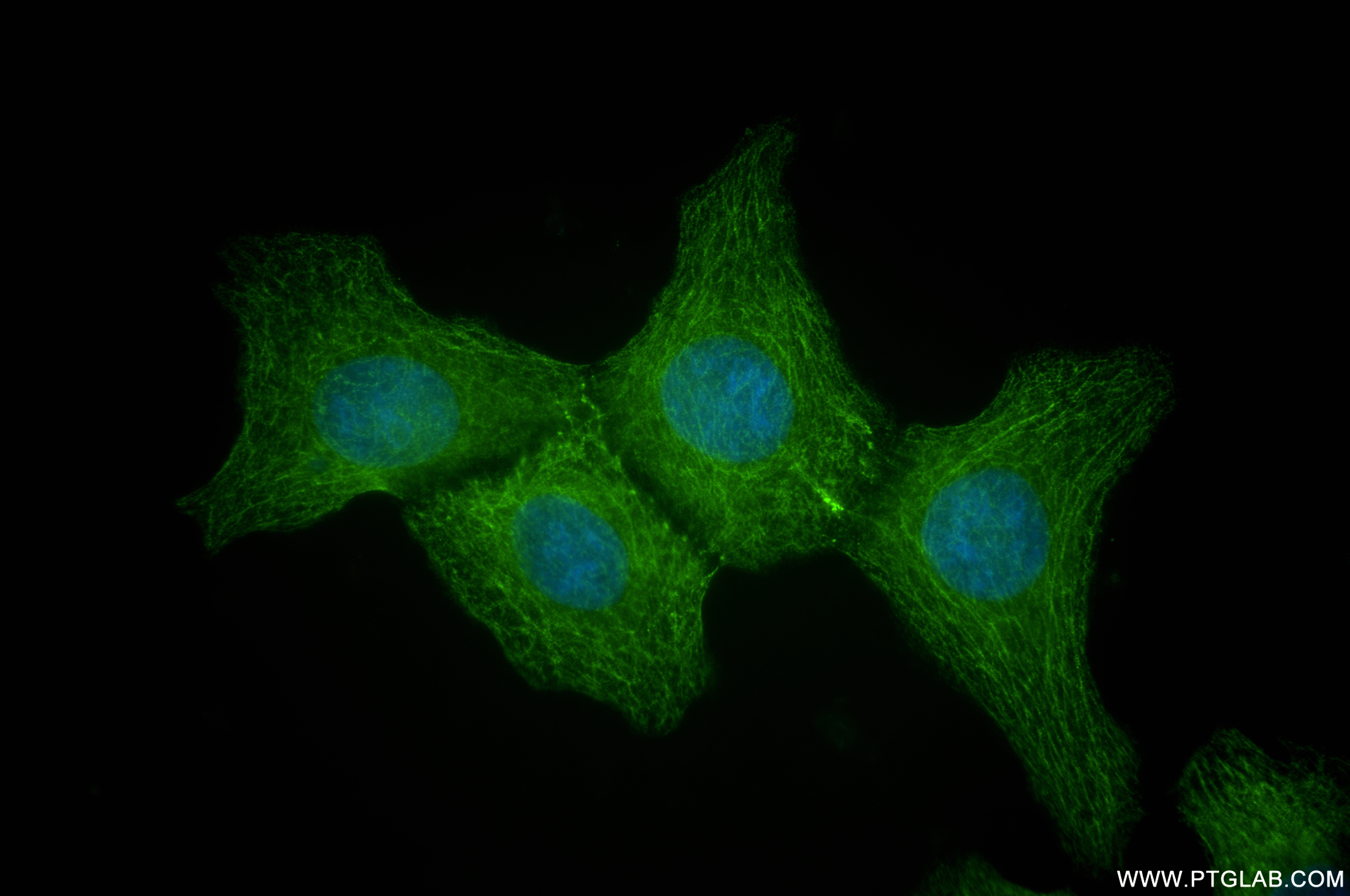 Immunofluorescence (IF) / fluorescent staining of A431 cells using PLEC Recombinant antibody (83898-1-RR)