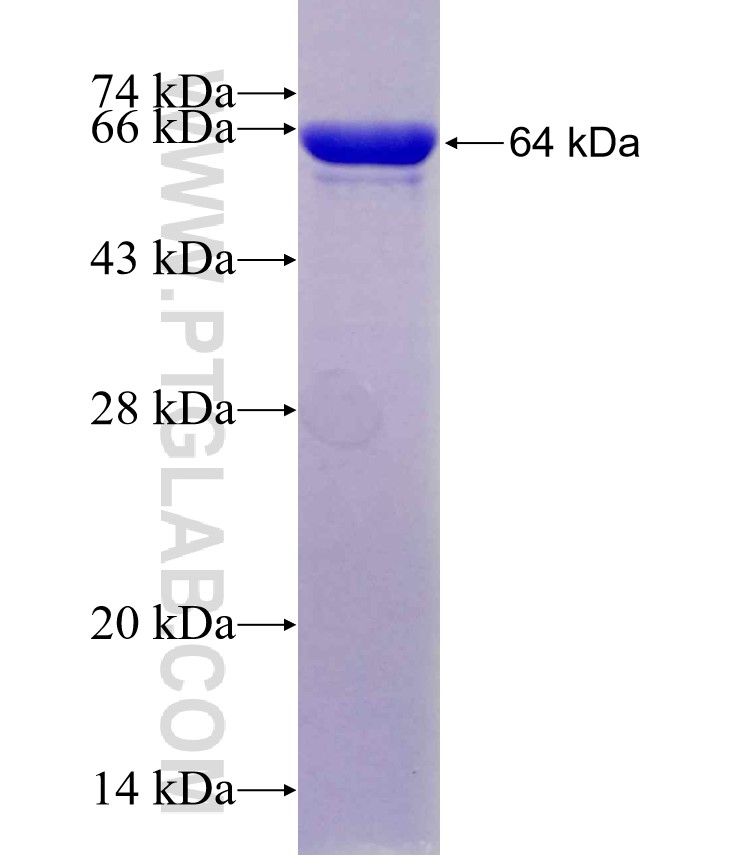 PLEC fusion protein Ag29418 SDS-PAGE