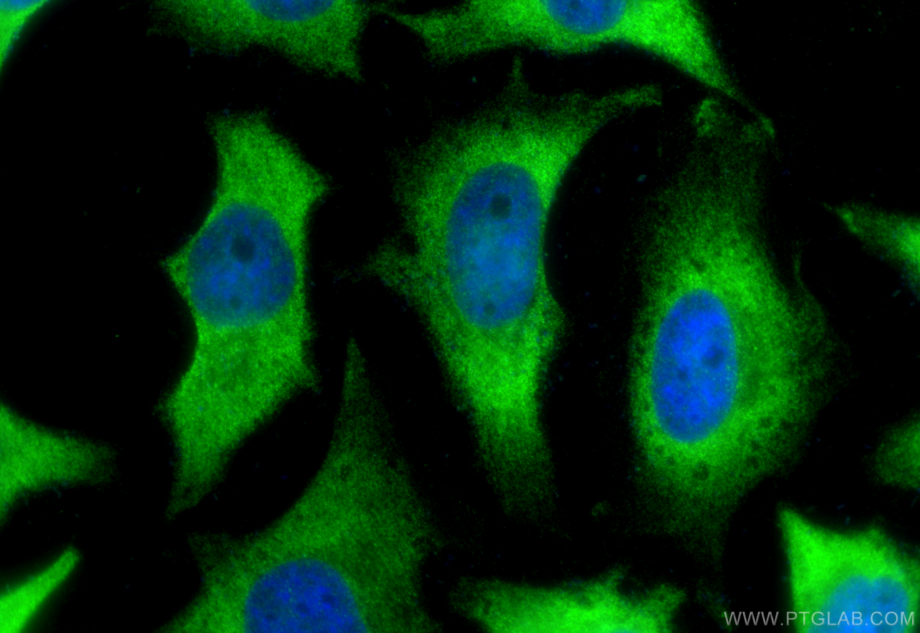 Immunofluorescence (IF) / fluorescent staining of HeLa cells using PLEKHO2 Polyclonal antibody (21356-1-AP)