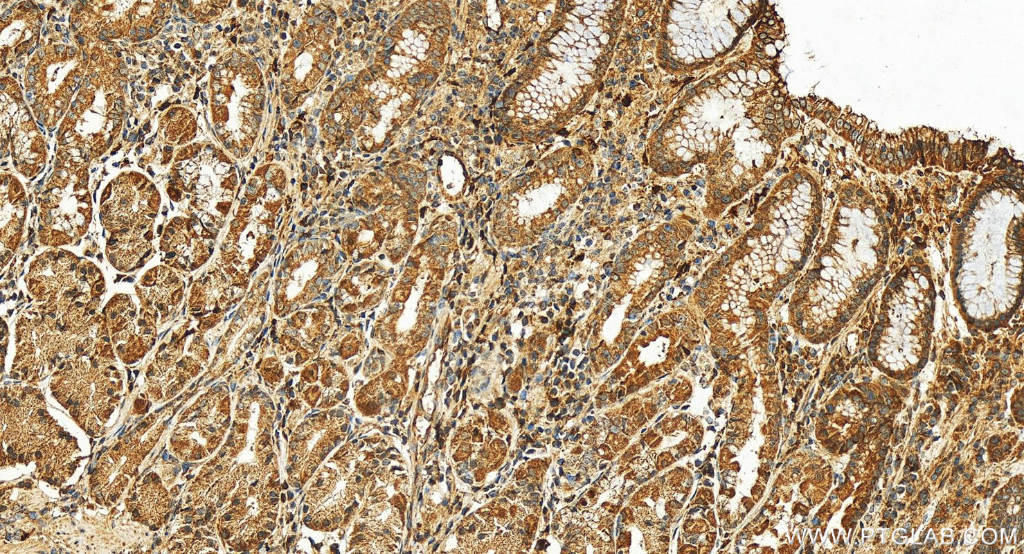 Immunohistochemistry (IHC) staining of human stomach tissue using Plasminogen Polyclonal antibody (17462-1-AP)