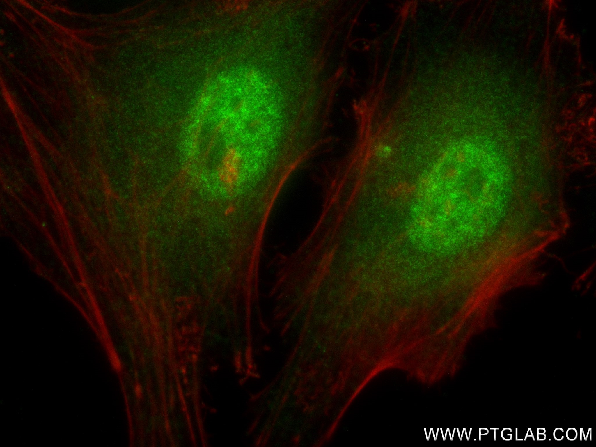 Immunofluorescence (IF) / fluorescent staining of HeLa cells using PLK1 Recombinant antibody (83260-5-RR)